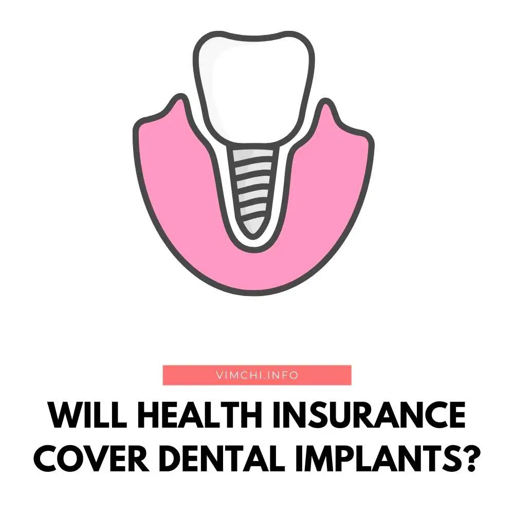 Will Health Insurance Cover Dental Implants Vim Ch i